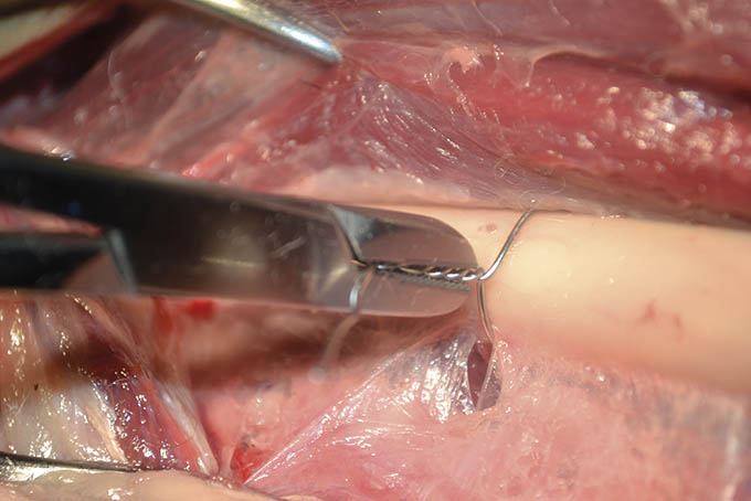 Orthopaedic Wire Forceps (TC)
