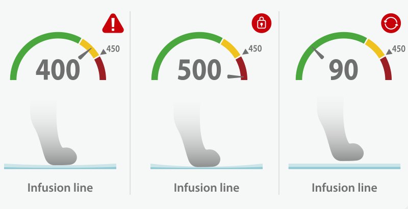 AniFM S3 Syringe Pump - Image 2